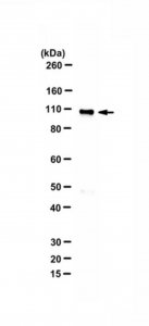 Anti-Histone acetyltransferase KAT2A 
