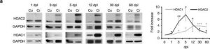 Anti-Histone Deacetylase 2 (HDAC2) antibody, Mouse monoclonal 