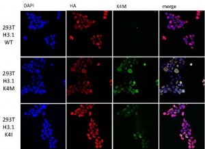 Anti-Histone H3 K4M mutant 