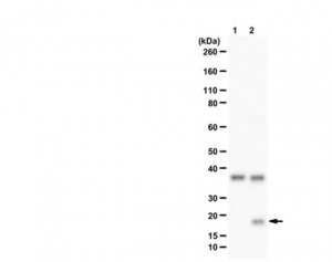 Anti-Histone H3.3 K27I 