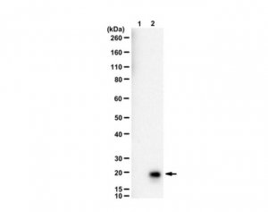 Anti-Histone H3.3 K36I Mutant 