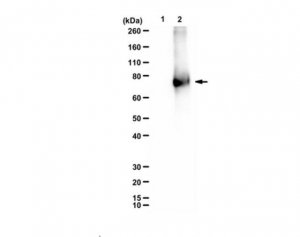 Anti-HMG-Lysine 