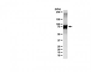 Anti-HMG-Lysine 