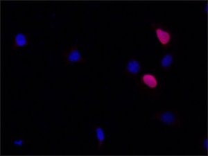 Anti-HOXD9 (Internal Region) antibody produced in rabbit 