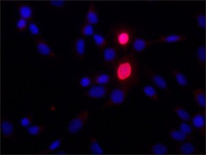 Anti-HOXD9 antibody produced in rabbit 