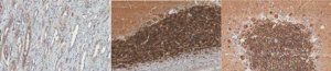 Anti-HPCAL1 Antibody, clone 5A5 