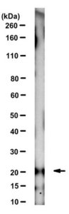 Anti-HPCAL1 Antibody, clone 5A5 