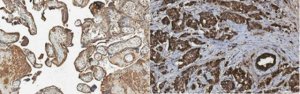 Anti-HSD17B10 Antibody, clone 5F3 