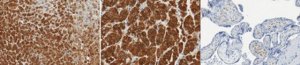 Anti-HSD3B2 Antibody, clone 6 