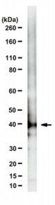 Anti-HSD3B2 Antibody, clone 6 