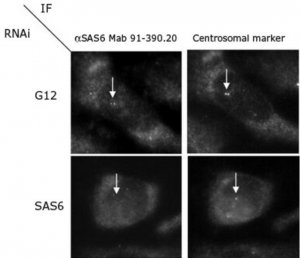 Anti-HsSAS-6 Antibody, clone 91.390.21 MABE1064-25UG