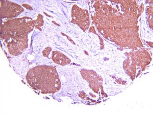 Anti-Hypoxia Inducible Factor 1 Antibody, clone H167 