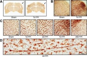 Anti-Iba1/AIF1 Antibody 