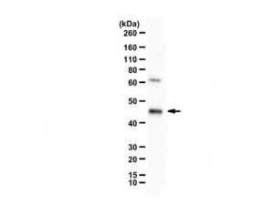 Anti-ICDH 