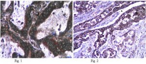 Anti-iNOS/NOS II Antibody, NT 
