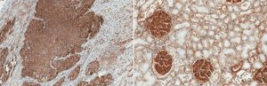 Anti-Integrin beta-1 Antibody, clone 102DF5 