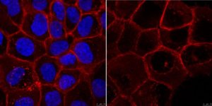 Anti-Integrin beta1 (CD29) Antibody, clone mAb13 