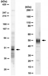 Anti-IRF-1 