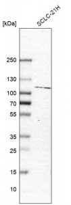 Anti-JADE1 antibody produced in rabbit 