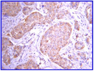 Anti-JAK2 Antibody, clone 8E10.2 