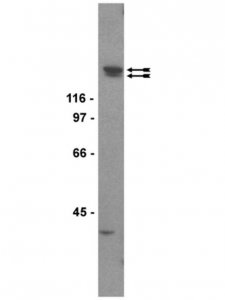 Anti-KDR/Flk-1/VEGFR2 Antibody, clone CH-11 