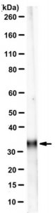 Anti-Ketohexokinase Isoform C Antibody, clone 5F1-3F5 