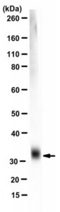 Anti-Ketohexokinase Isoform C Antibody, clone 5F1-3F5 