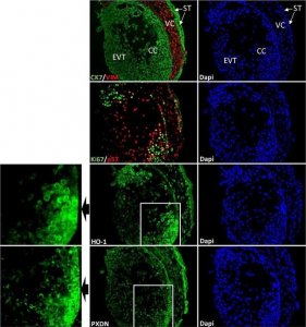 Anti-Ki-67 Antibody, clone Ki-S5 