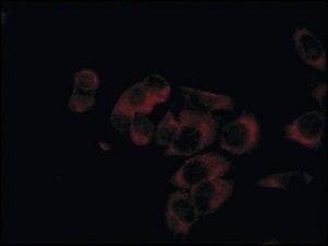 Anti-KTN1 antibody produced in rabbit 