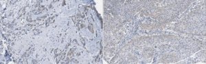 Anti-LATS1 Antibody, clone 9A3.1 