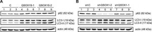 Anti-LC3 antibody produced in rabbit 