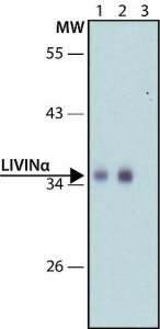 Anti-Livin antibody produced in rabbit 
