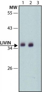 Anti-Livin (C-terminal) antibody produced in rabbit 