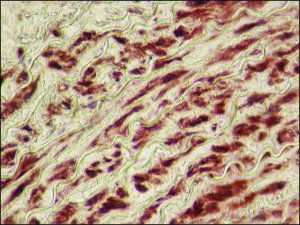 Anti-LMOD1 antibody produced in rabbit 