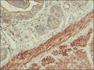 Anti-LMOD1 antibody produced in rabbit 