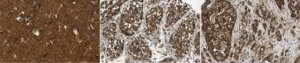 Anti-LRRK1 Antibody, clone 12F2.1 