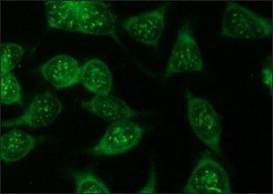 Anti-Luciferase antibody produced in rabbit 