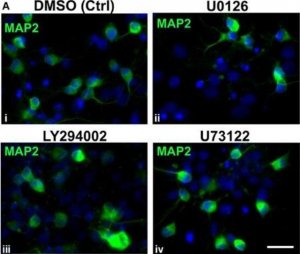 Anti-MAP2 Antibody, clone AP20 
