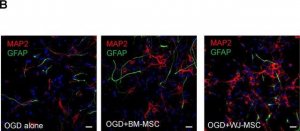 Anti-MAP2 Antibody, clone AP20 