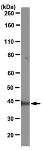 Anti-Mcl-1 Antibody, clone RC13 