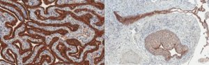 Anti-Mesothelin Antibody, clone MN-1 
