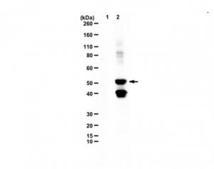 Anti-Methyl-Glutamine 
