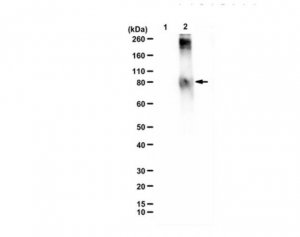 Anti-methylglutaryl-lysine 
