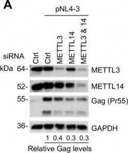 Anti-METTL14 antibody produced in rabbit 
