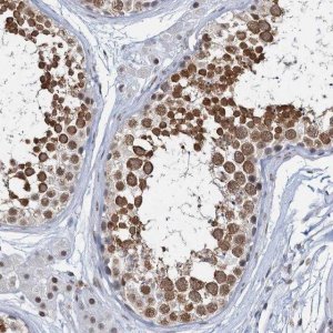 Anti-METTL14 antibody produced in rabbit 
