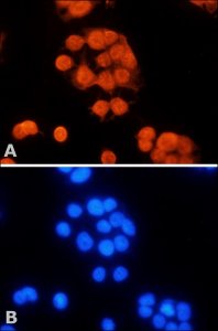 Anti-MLH1 (N-terminal) antibody produced in rabbit 