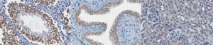 Anti-MLL-3 