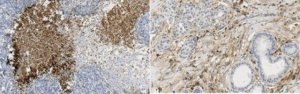 Anti-MMP-11 (Stromelysin-3) Antibody, clone 5ST-4A9 MABC1607-25UG