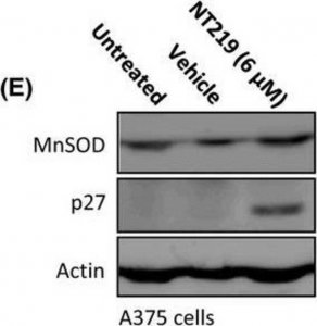 Anti-Mn-SOD Antibody 