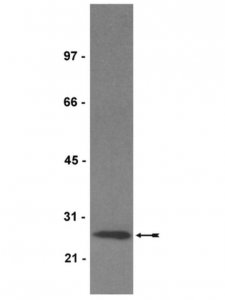 Anti-Mn-SOD Antibody 